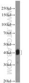 Fc Fragment Of IgE Receptor II antibody, 18642-1-AP, Proteintech Group, Western Blot image 
