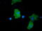 Protein Kinase D2 antibody, LS-C115588, Lifespan Biosciences, Immunofluorescence image 