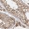 VPS50 Subunit Of EARP/GARPII Complex antibody, NBP1-88012, Novus Biologicals, Immunohistochemistry paraffin image 