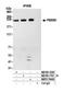 Polybromo 1 antibody, NBP2-76400, Novus Biologicals, Immunoprecipitation image 