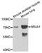 Nuclear Receptor Subfamily 4 Group A Member 1 antibody, abx005118, Abbexa, Western Blot image 