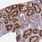 Major Facilitator Superfamily Domain Containing 8 antibody, HPA044802, Atlas Antibodies, Immunohistochemistry paraffin image 