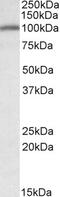 Ubiquitin Protein Ligase E3 Component N-Recognin 4 antibody, 42-191, ProSci, Enzyme Linked Immunosorbent Assay image 