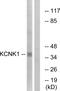 Potassium Two Pore Domain Channel Subfamily K Member 1 antibody, PA5-39342, Invitrogen Antibodies, Western Blot image 