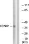 Potassium Two Pore Domain Channel Subfamily K Member 1 antibody, PA5-39342, Invitrogen Antibodies, Western Blot image 