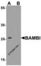 BMP And Activin Membrane Bound Inhibitor antibody, 7931, ProSci, Western Blot image 