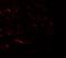 Vacuolar protein sorting-associated protein 13B antibody, GTX32078, GeneTex, Immunohistochemistry paraffin image 