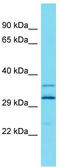 ADP Ribosylation Factor Like GTPase 13A antibody, TA334905, Origene, Western Blot image 