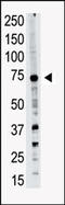 PR/SET Domain 14 antibody, AP11206PU-N, Origene, Western Blot image 