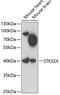Serine/Threonine Kinase 32A antibody, 23-055, ProSci, Western Blot image 