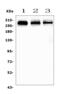 Filamin A antibody, A00502-1, Boster Biological Technology, Western Blot image 