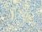 Homeobox B5 antibody, LS-C375907, Lifespan Biosciences, Immunohistochemistry frozen image 