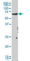 Checkpoint Kinase 2 antibody, LS-C133682, Lifespan Biosciences, Western Blot image 