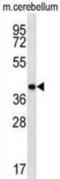 Homeobox D13 antibody, abx028582, Abbexa, Western Blot image 