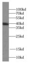 Kallikrein Related Peptidase 11 antibody, FNab04457, FineTest, Western Blot image 