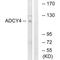 Adenylate Cyclase 4 antibody, A10911, Boster Biological Technology, Western Blot image 