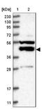 P2Y Receptor Family Member 10 antibody, NBP1-82438, Novus Biologicals, Western Blot image 