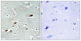 Q92993-3 antibody, abx013741, Abbexa, Western Blot image 