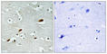 Lysine Acetyltransferase 5 antibody, abx013741, Abbexa, Western Blot image 