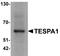 Thymocyte Expressed, Positive Selection Associated 1 antibody, TA326689, Origene, Western Blot image 