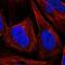 Centrosomal Protein 164 antibody, NBP1-81445, Novus Biologicals, Immunocytochemistry image 