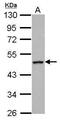 Regulator Of G Protein Signaling 6 antibody, PA5-30876, Invitrogen Antibodies, Western Blot image 