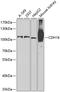 Cadherin 16 antibody, 23-251, ProSci, Western Blot image 
