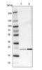 Parkinsonism Associated Deglycase antibody, NBP2-54654, Novus Biologicals, Western Blot image 