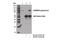 ADAM Metallopeptidase Domain 10 antibody, 14194S, Cell Signaling Technology, Immunoprecipitation image 