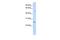 Ferritin Heavy Chain Like 17 antibody, GTX45940, GeneTex, Western Blot image 