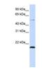 Zinc Finger Protein 683 antibody, NBP1-80186, Novus Biologicals, Western Blot image 