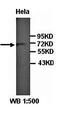 RAD17 Checkpoint Clamp Loader Component antibody, orb77254, Biorbyt, Western Blot image 