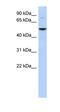 Lysine Acetyltransferase 5 antibody, orb324471, Biorbyt, Western Blot image 