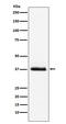 Parathyroid Hormone antibody, M00208-2, Boster Biological Technology, Western Blot image 