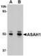 N-Acylsphingosine Amidohydrolase 1 antibody, LS-B3136, Lifespan Biosciences, Western Blot image 