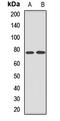 Mitochondrial import receptor subunit TOM70 antibody, LS-C668747, Lifespan Biosciences, Western Blot image 