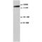 Glutamate Ionotropic Receptor NMDA Type Subunit 2A antibody, LS-C312293, Lifespan Biosciences, Western Blot image 
