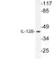 Interleukin 12B antibody, LS-C199900, Lifespan Biosciences, Western Blot image 