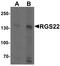 Regulator Of G Protein Signaling 22 antibody, LS-B8855, Lifespan Biosciences, Western Blot image 