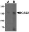 Regulator of G-protein signaling 22 antibody, LS-B8855, Lifespan Biosciences, Western Blot image 