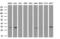 Uridine-Cytidine Kinase 1 antibody, GTX83446, GeneTex, Western Blot image 