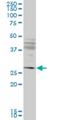 Intraflagellar Transport 57 antibody, H00055081-M02, Novus Biologicals, Western Blot image 