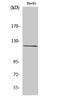 FERM, ARH/RhoGEF And Pleckstrin Domain Protein 2 antibody, STJ93077, St John