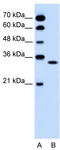 Olfactory Receptor Family 5 Subfamily T Member 2 antibody, TA346243, Origene, Western Blot image 