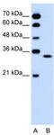 Olfactory Receptor Family 5 Subfamily T Member 2 antibody, TA346243, Origene, Western Blot image 