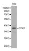 Cyclin Dependent Kinase 7 antibody, abx001421, Abbexa, Western Blot image 