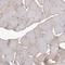 Tumor protein D52 antibody, HPA028427, Atlas Antibodies, Immunohistochemistry paraffin image 