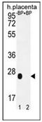 Olfactory Receptor Family 2 Subfamily J Member 3 antibody, AP53031PU-N, Origene, Western Blot image 