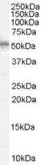WT1 Transcription Factor antibody, MBS420345, MyBioSource, Western Blot image 