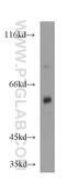 Cytochrome P450 Family 4 Subfamily A Member 11 antibody, 11688-1-AP, Proteintech Group, Western Blot image 